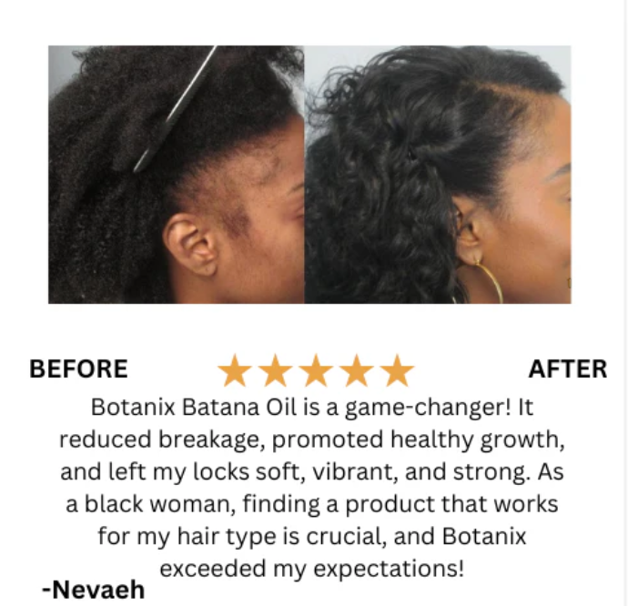 Raw Batana Oil for Hair Growth - 100% Pure, Organic 4oz Batana from Honduras for Thick and Strong Natural Hair - Dr. Sebi Unrefined Cold Pressed Cosmetic Scalp Mask for Men & Women (1 Pack)