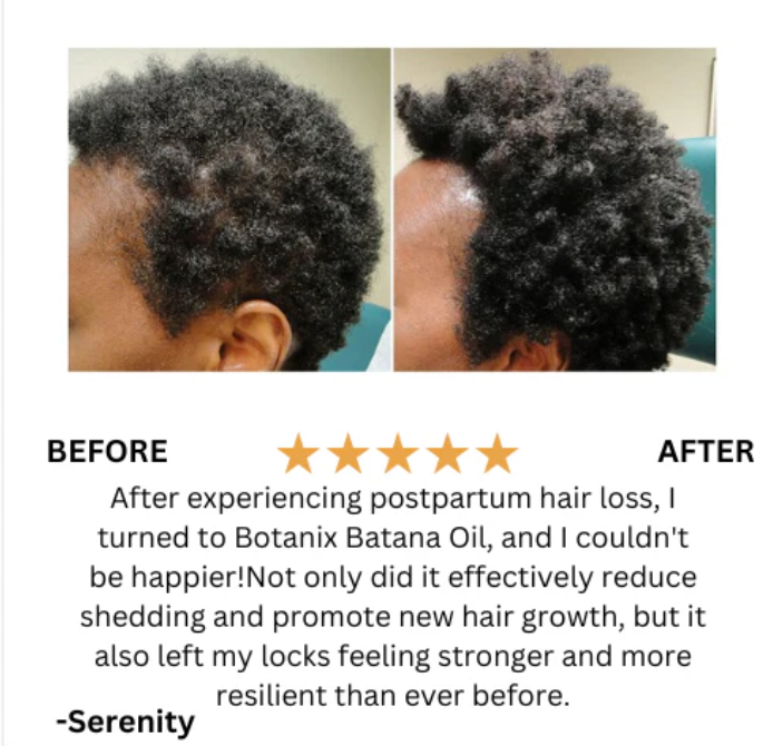 Raw Batana Oil for Hair Growth - 100% Pure, Organic 4oz Batana from Honduras for Thick and Strong Natural Hair - Dr. Sebi Unrefined Cold Pressed Cosmetic Scalp Mask for Men & Women (1 Pack)