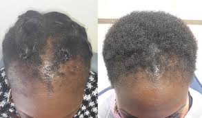 4-in-1 Batana Hair Revival Kit – Oil, Shampoo, Conditioner & Mask